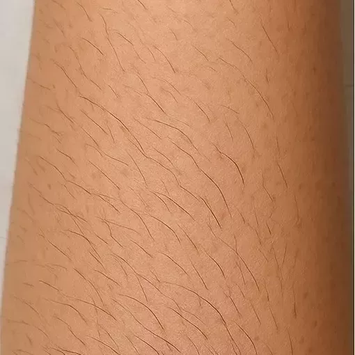 Peau foncée lisse avant une séance d’épilation définitive par électrolyse